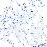 MMP9 Antibody in Immunohistochemistry (Paraffin) (IHC (P))