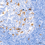 MMP9 Antibody in Immunohistochemistry (Paraffin) (IHC (P))