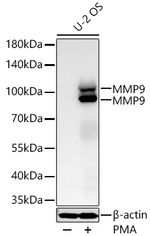 MMP9 Antibody in Western Blot (WB)