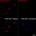 COX2 Recombinant Rabbit Monoclonal Antibody (10E2E9)