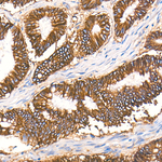 Sodium Potassium ATPase Antibody in Immunohistochemistry (Paraffin) (IHC (P))