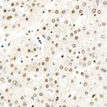 Phospho-PP1 alpha (Thr320) Antibody in Immunohistochemistry (Paraffin) (IHC (P))