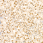 Phospho-PP1 alpha (Thr320) Recombinant Rabbit Monoclonal Antibody (7W8T8)