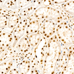 Phospho-PP1 alpha (Thr320) Antibody in Immunohistochemistry (Paraffin) (IHC (P))