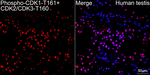 Phospho-CDK1/CDK2/CDK3 (Thr161, Thr160) Antibody in Immunohistochemistry (Paraffin) (IHC (P))
