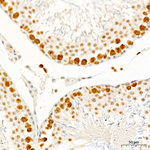 Phospho-CDK1/CDK2/CDK3 (Thr161, Thr160) Antibody in Immunohistochemistry (Paraffin) (IHC (P))