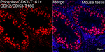 Phospho-CDK1/CDK2/CDK3 (Thr161, Thr160) Antibody in Immunohistochemistry (Paraffin) (IHC (P))