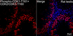 Phospho-CDK1/CDK2/CDK3 (Thr161, Thr160) Antibody in Immunohistochemistry (Paraffin) (IHC (P))