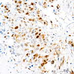 Phospho-CDK1/CDK2/CDK3 (Thr161, Thr160) Antibody in Immunohistochemistry (Paraffin) (IHC (P))