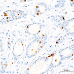 Phospho-CDK1/CDK2/CDK3 (Thr161, Thr160) Antibody in Immunohistochemistry (Paraffin) (IHC (P))