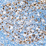 Phospho-CDK1/CDK2/CDK3 (Thr161, Thr160) Antibody in Immunohistochemistry (Paraffin) (IHC (P))