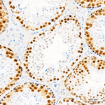 Phospho-CDK1/CDK2/CDK3 (Thr161, Thr160) Antibody in Immunohistochemistry (Paraffin) (IHC (P))