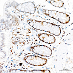 Phospho-CDK1/CDK2/CDK3 (Thr161, Thr160) Antibody in Immunohistochemistry (Paraffin) (IHC (P))