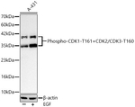 Phospho-CDK1/CDK2/CDK3 (Thr161, Thr160) Antibody in Western Blot (WB)