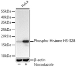 Phospho-Histone H3 (Ser28) Antibody in Western Blot (WB)
