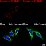Phospho-mTOR (Ser2448) Recombinant Rabbit Monoclonal Antibody (2Z4L3)