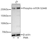 Phospho-mTOR (Ser2448) Antibody in Western Blot (WB)
