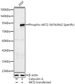 Phospho-AKT2 (Ser474) Recombinant Rabbit Monoclonal Antibody (8C4X1)
