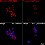 Phospho-VASP (Ser239) Recombinant Rabbit Monoclonal Antibody (5J0N3)