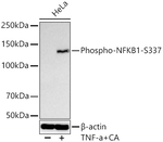 Phospho-NFkB p105 (Ser337) Recombinant Rabbit Monoclonal Antibody (10C3I2)