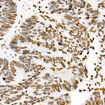 Phospho-STAT3 (Tyr705) Antibody in Immunohistochemistry (Paraffin) (IHC (P))