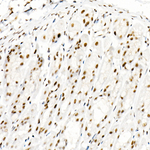 Phospho-STAT3 (Tyr705) Recombinant Rabbit Monoclonal Antibody (4Z1N1)