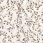 Phospho-STAT3 (Tyr705) Antibody in Immunohistochemistry (Paraffin) (IHC (P))