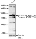 Phospho-STAT3 (Tyr705) Antibody in Western Blot (WB)