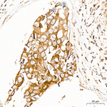 Phospho-BAD (Ser112) Recombinant Rabbit Monoclonal Antibody (4T8L8)