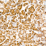 Phospho-BAD (Ser112) Antibody in Immunohistochemistry (Paraffin) (IHC (P))