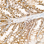 Phospho-BAD (Ser112) Antibody in Immunohistochemistry (Paraffin) (IHC (P))