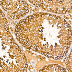 Phospho-BAD (Ser112) Antibody in Immunohistochemistry (Paraffin) (IHC (P))