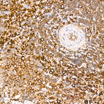 Phospho-BAD (Ser112) Antibody in Immunohistochemistry (Paraffin) (IHC (P))