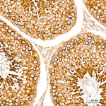 Phospho-BAD (Ser112) Antibody in Immunohistochemistry (Paraffin) (IHC (P))
