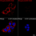 Phospho-EGFR (Tyr845) Recombinant Rabbit Monoclonal Antibody (4V8K7)