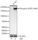 Phospho-EGFR (Tyr845) Antibody in Western Blot (WB)