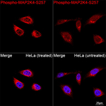 Phospho-MAP2K4 (Ser257) Recombinant Rabbit Monoclonal Antibody (1B7B6)