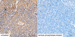 Phospho-MAP2K4 (Ser257) Antibody in Immunohistochemistry (Paraffin) (IHC (P))