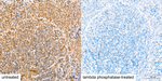 Phospho-MAP2K4 (Ser257) Antibody in Immunohistochemistry (Paraffin) (IHC (P))