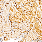 Phospho-MAP2K4 (Ser257) Antibody in Immunohistochemistry (Paraffin) (IHC (P))