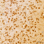 Phospho-MAP2K4 (Ser257) Antibody in Immunohistochemistry (Paraffin) (IHC (P))