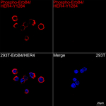 Phospho-ErbB4 (Tyr1284) Recombinant Rabbit Monoclonal Antibody (2M5N9)