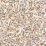 Phospho-RPA32 (Ser33) Antibody in Immunohistochemistry (Paraffin) (IHC (P))