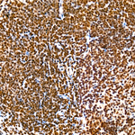 Phospho-RPA32 (Ser33) Recombinant Rabbit Monoclonal Antibody (9J4B7)