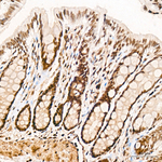 Phospho-RPA32 (Ser33) Antibody in Immunohistochemistry (Paraffin) (IHC (P))