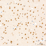 Phospho-AKT Pan (Ser473) Antibody in Immunohistochemistry (Paraffin) (IHC (P))