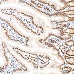 Phospho-AKT Pan (Ser473) Antibody in Immunohistochemistry (Paraffin) (IHC (P))