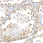 Phospho-AKT Pan (Ser473) Antibody in Immunohistochemistry (Paraffin) (IHC (P))