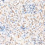 Phospho-AKT Pan (Ser473) Antibody in Immunohistochemistry (Paraffin) (IHC (P))