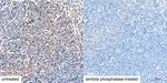 Phospho-AKT Pan (Ser473) Antibody in Immunohistochemistry (Paraffin) (IHC (P))